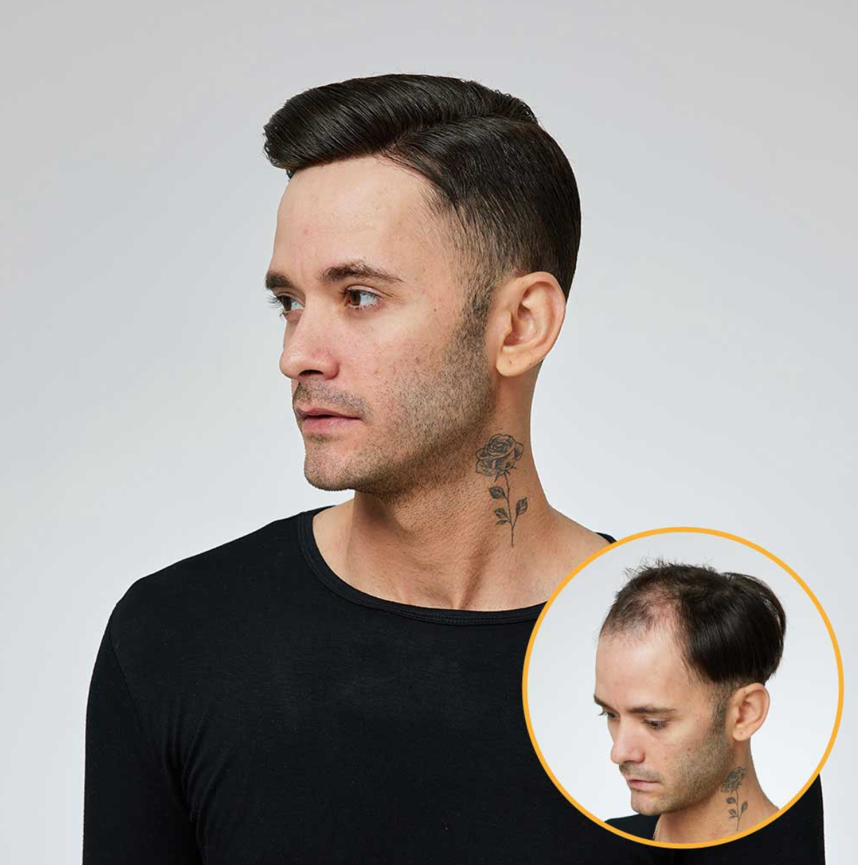 N6: Swiss Lace Men's Hair System With PU Sides and Back (90% - 120% Densities)
