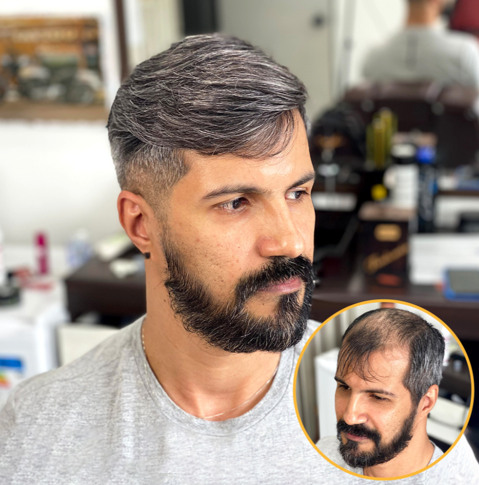 HS1V(M) : V-Loop Men's Hair System 0.06 mm Poly Thin Skin with various density options (100% -130% Density)