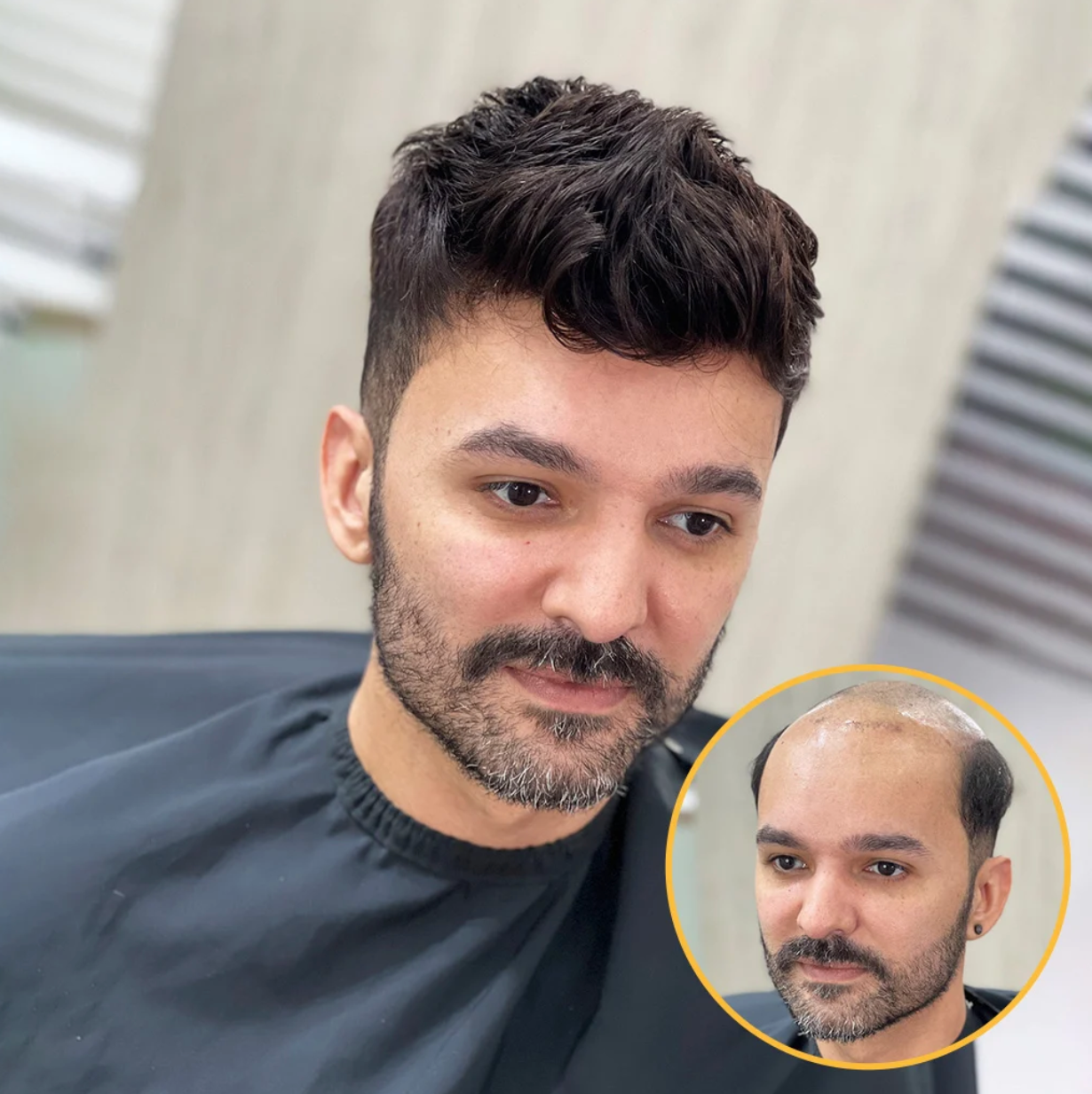 AUSTRALIA : Men's Lace Hair System With PU Perimeter  - Various Sizes Available (120% Density)