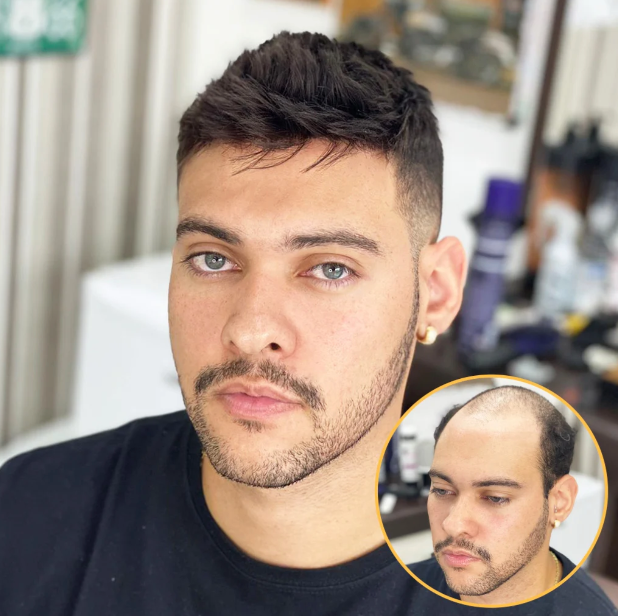 NCON: Fine Welded Mono Base Hair System (100% Density)