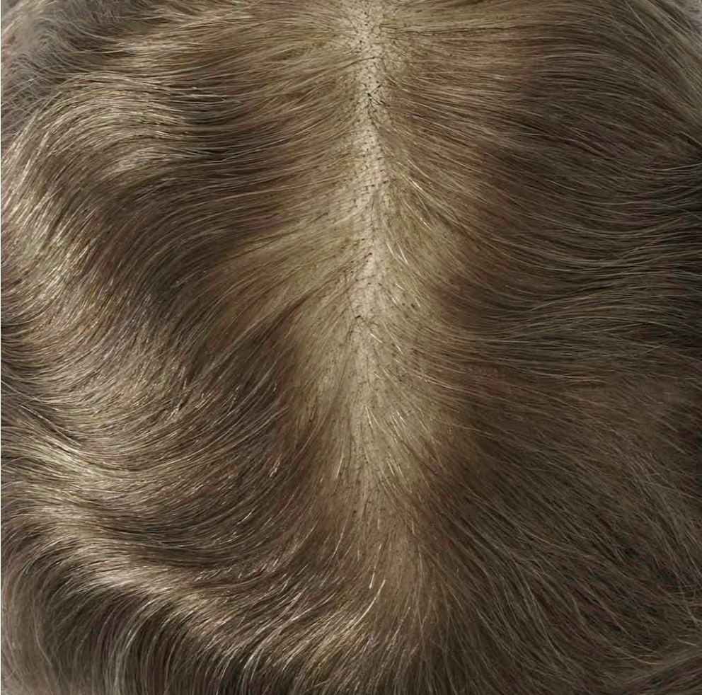 NCONAL LIGHT: Fine Welded Mono Base Hair System with 80% Density (80% Density)
