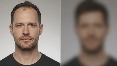 before and after images of mens hair systems